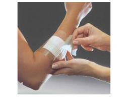 smith nephew srl film adesivo in poliuretano in rotolo trasparente impermeabile per fissaggio di medicazioni e cateteri 5x1000 1med ean 5000223411466